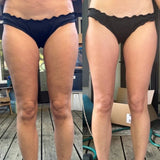 Nimbest™ - Anti-Cellulite Massager